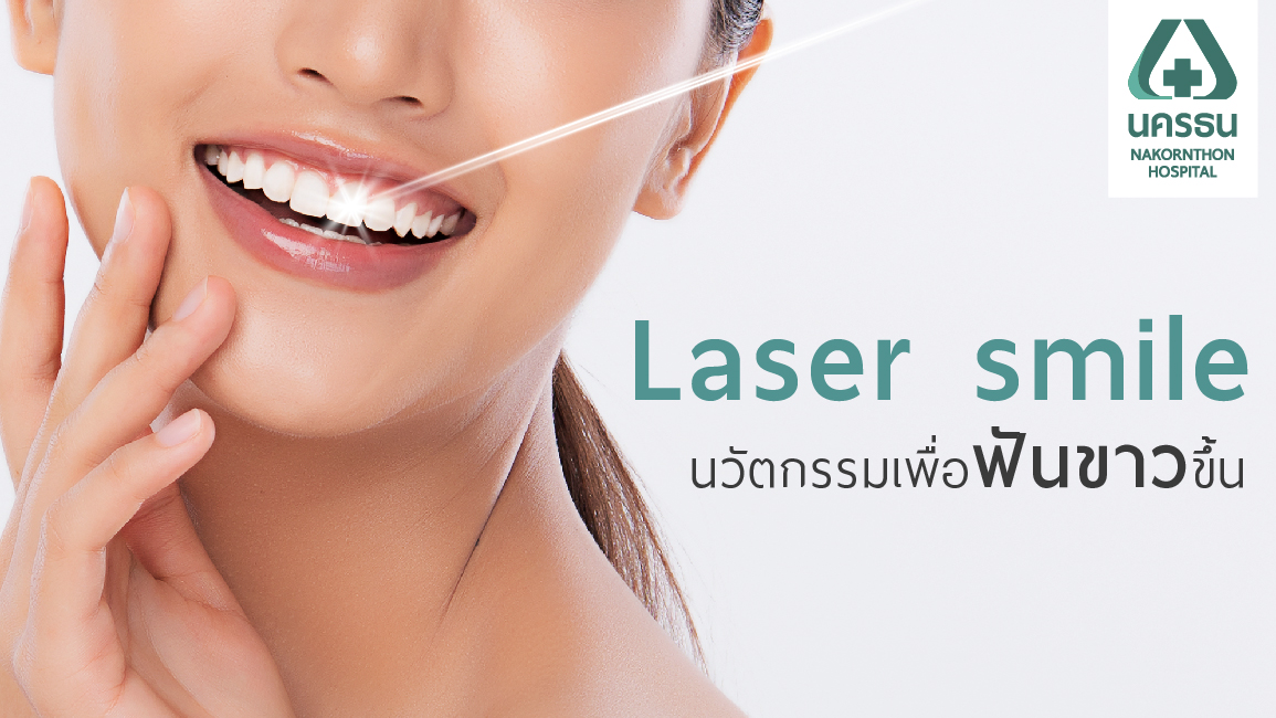 ฟอกสีฟันด้วย Laser smile เดินออกไปด้วยรอยยิ้มที่ขาวสดใส